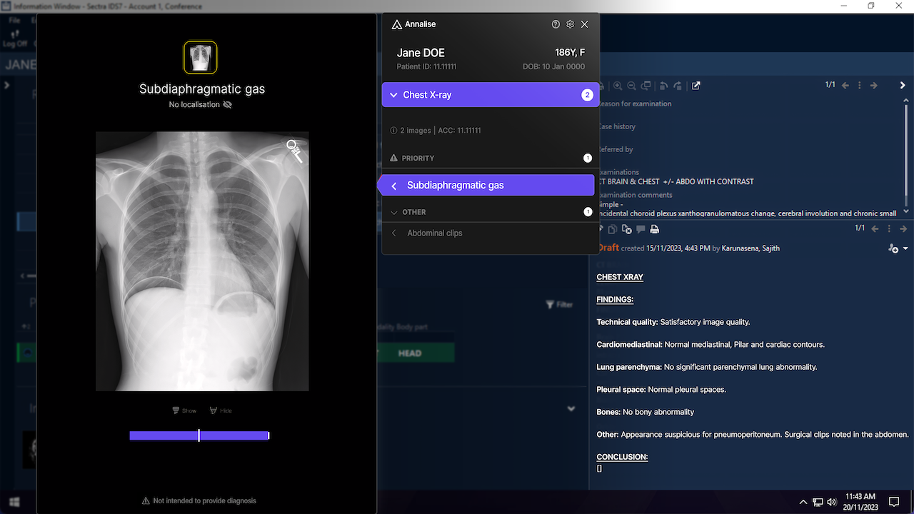 Annalise Enterprise Radiology AI Solutions preview 1