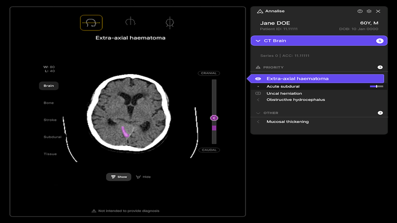 Annalise Enterprise Radiology AI Solutions preview 3