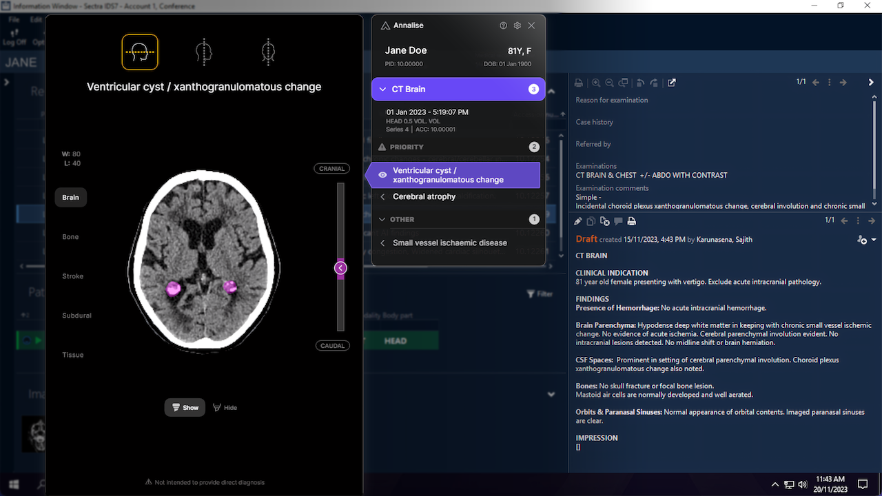 Annalise Enterprise Radiology AI Solutions preview 2