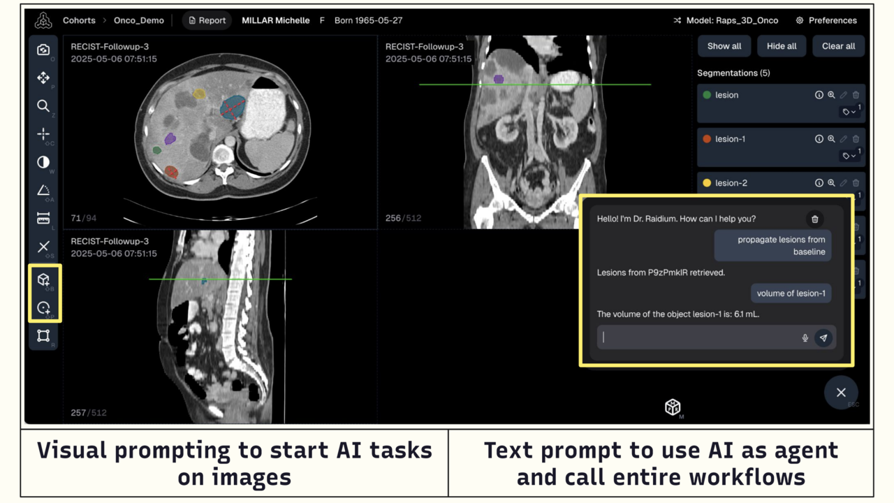 Raidium Viewer preview 2