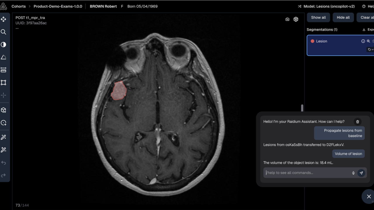 Raidium Viewer preview 3