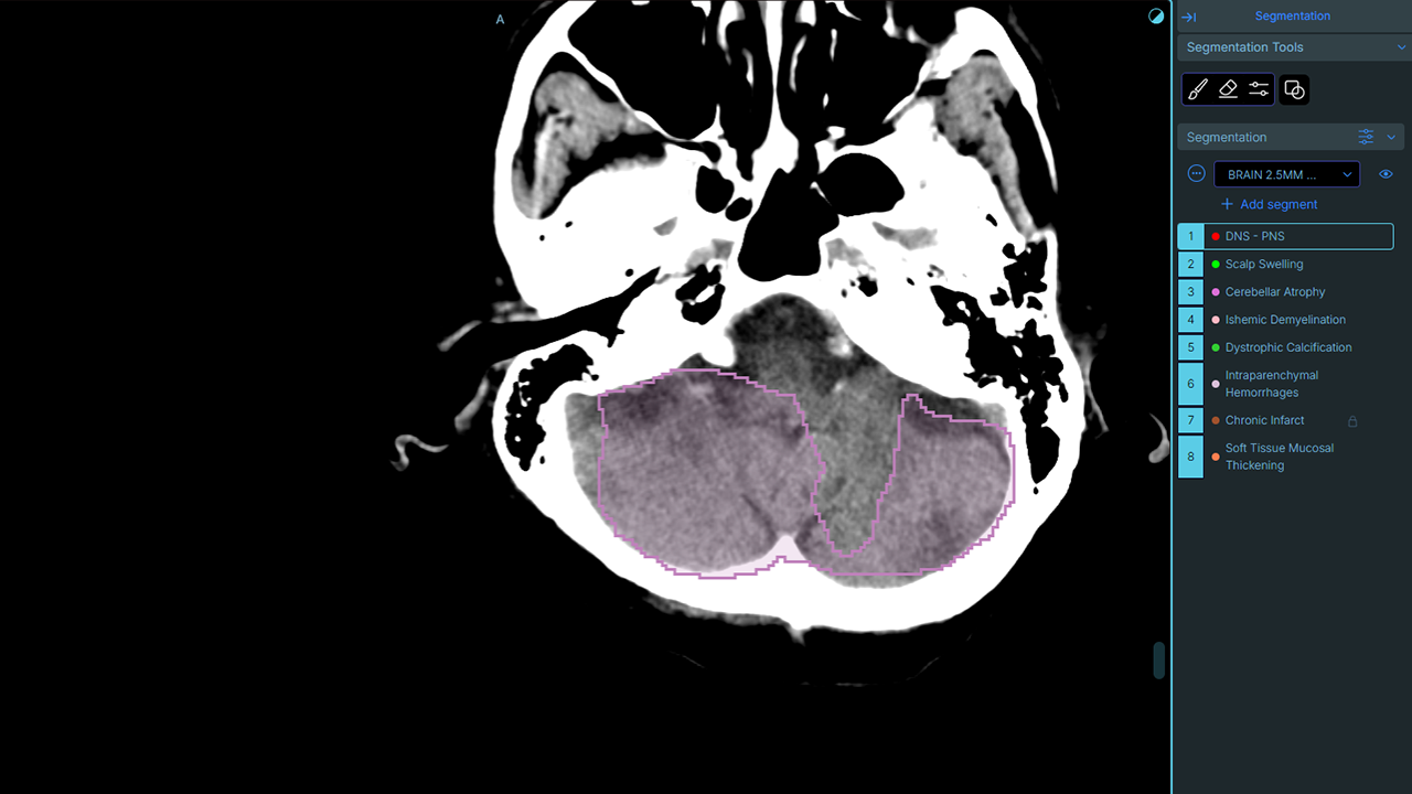 Scaida - BrainCT preview 4